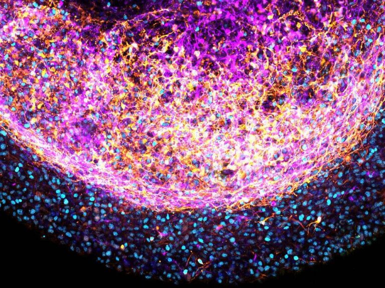 Científicos crean minicerebros con tejido fetal para estudiar el cerebro humano y sus enfermedades