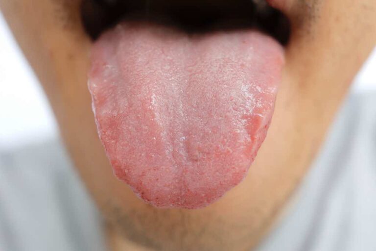 Healthy tongue of Asian male.