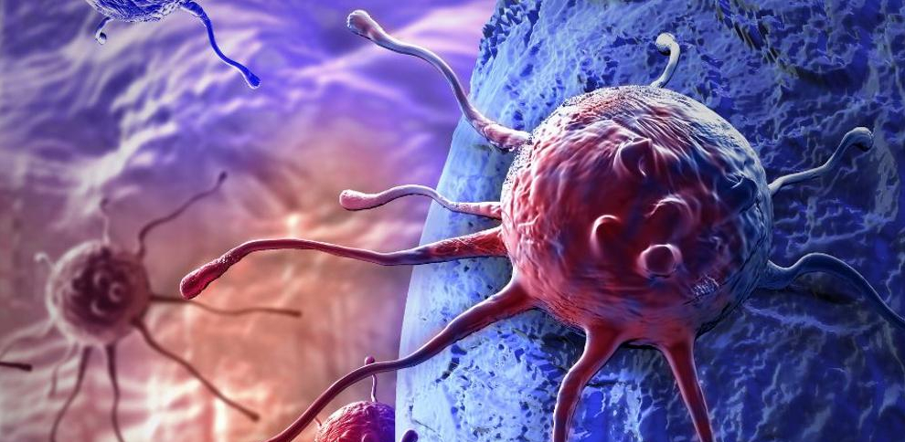 Estilo de vida y edad: factores clave en aumento de casos de cáncer