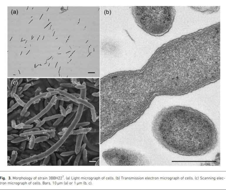 Estudios revelan beneficios del café para la microbiota intestinal