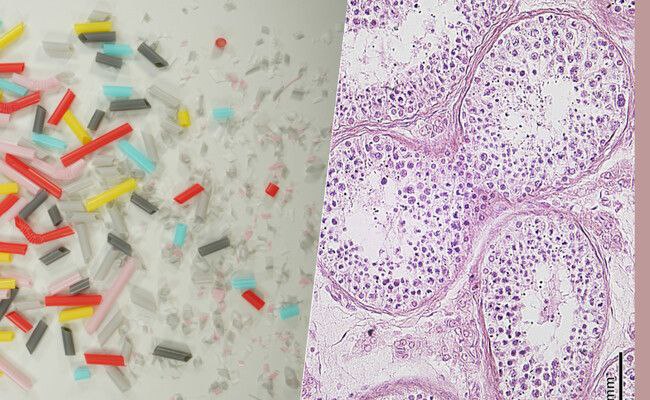 Microplásticos en el sistema reproductivo humano