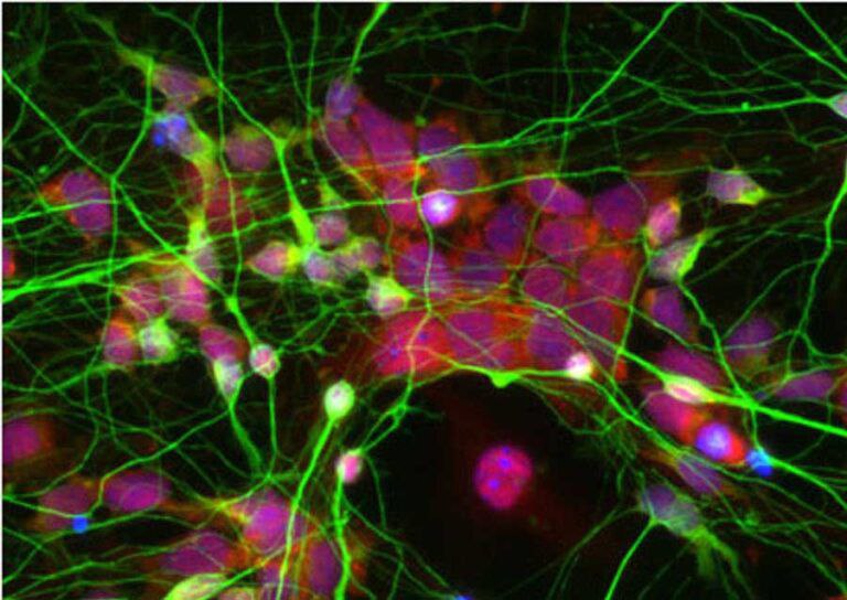 Investigadores identifican neuronas implicadas en la regulación de la ansiedad y trastornos sociales