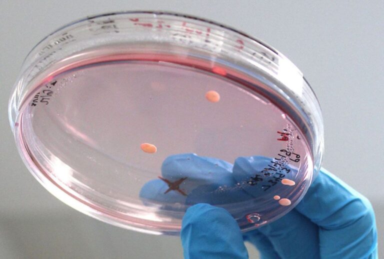 Investigadores cultivan mini-cerebros para estudiar enfermedades neurológicas complejas